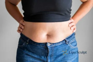 Bidding Farewell to Muffin Tops with Aqualyx Fat Injections 2 Do you wish you could reduce your muffin top Market Harborough With Aqualy fat dissolving injections you can!