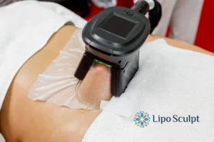 Does Fat Freezing At Home Work? 3 Fat freezing at home from Lipo Sculpt Market Harborough